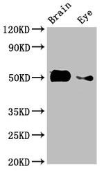 alpha Tubulin Polyclonal Antibody
