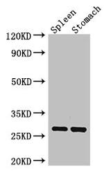 CTRB1 Antibody in Western Blot (WB)