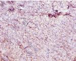CES1 Polyclonal Antibody