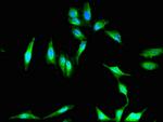 PKHD1 Polyclonal Antibody