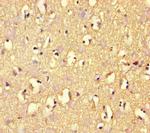 ARHGAP42 Antibody in Immunohistochemistry (Paraffin) (IHC (P))
