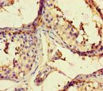 ARHGAP42 Polyclonal Antibody