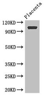 ARHGAP42 Antibody in Western Blot (WB)