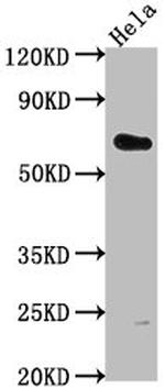 USP17L5 Antibody in Western Blot (WB)