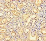 B4GALT5 Polyclonal Antibody