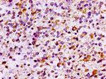 IL10RB Antibody in Immunohistochemistry (Paraffin) (IHC (P))