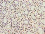 MRPL49 Antibody in Immunohistochemistry (Paraffin) (IHC (P))