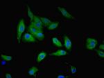 GALE Polyclonal Antibody