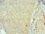 SSX2 Polyclonal Antibody