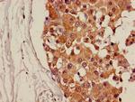 CDH18 Antibody in Immunohistochemistry (Paraffin) (IHC (P))