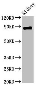 CDH18 Antibody in Western Blot (WB)