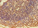FKBP8 Antibody in Immunohistochemistry (Paraffin) (IHC (P))