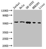 FKBP8 Antibody in Western Blot (WB)