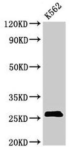 SPCS2 Antibody in Western Blot (WB)