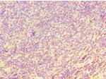 CHI3L2 Polyclonal Antibody