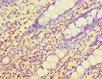 CHI3L2 Antibody in Immunohistochemistry (Paraffin) (IHC (P))