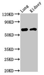 IQCB1 Antibody in Western Blot (WB)