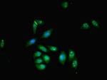 ZMYND11 Antibody in Immunocytochemistry (ICC/IF)