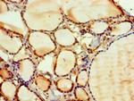 PAK2 Antibody in Immunohistochemistry (Paraffin) (IHC (P))