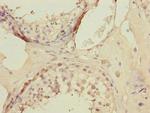 KLF9 Polyclonal Antibody