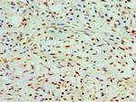 COTL1 Polyclonal Antibody