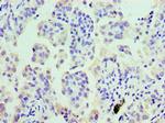 COTL1 Antibody in Immunohistochemistry (Paraffin) (IHC (P))