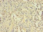 CENTB1 Antibody in Immunohistochemistry (Paraffin) (IHC (P))