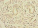 SLC4A8 Antibody in Immunohistochemistry (Paraffin) (IHC (P))