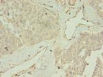 CCDC14 Polyclonal Antibody