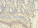 C5orf22 Antibody in Immunohistochemistry (Paraffin) (IHC (P))