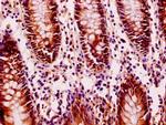 FILIP1L Antibody in Immunohistochemistry (Paraffin) (IHC (P))