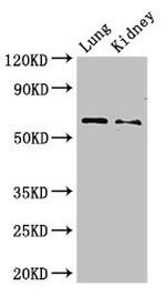 PLBD2 Polyclonal Antibody