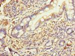HSD17B12 Antibody in Immunohistochemistry (Paraffin) (IHC (P))