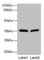 HSD17B12 Antibody in Western Blot (WB)
