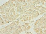 TNNI3K Polyclonal Antibody