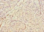 MEST Polyclonal Antibody