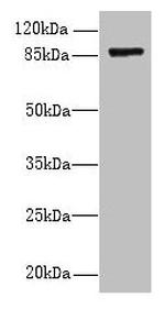 FSCB Antibody in Western Blot (WB)