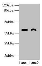 TMEM255A Antibody in Western Blot (WB)