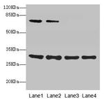 SPIN3 Antibody in Western Blot (WB)