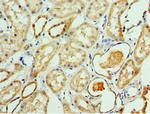 ATAD3B Antibody in Immunohistochemistry (Paraffin) (IHC (P))