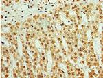 ATAD3B Antibody in Immunohistochemistry (Paraffin) (IHC (P))