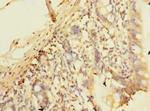 PLEKHS1 Antibody in Immunohistochemistry (Paraffin) (IHC (P))