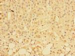 PLEKHS1 Polyclonal Antibody