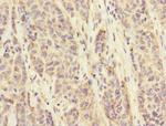 FCRL6 Antibody in Immunohistochemistry (Paraffin) (IHC (P))