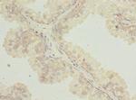 TTC38 Polyclonal Antibody