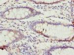 TTC38 Antibody in Immunohistochemistry (Paraffin) (IHC (P))