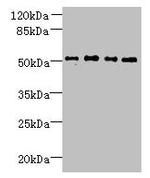 TTC38 Antibody in Western Blot (WB)
