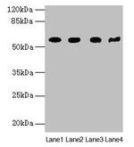 KRT79 Antibody in Western Blot (WB)