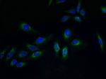 PVRIG Polyclonal Antibody