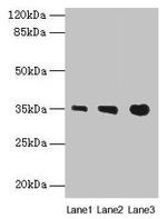 PVRIG Antibody in Western Blot (WB)